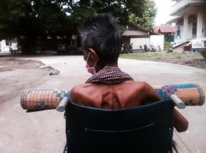 Scapulae of a TB patient in Cambodia, highlighting the level of malnutrition which occurs